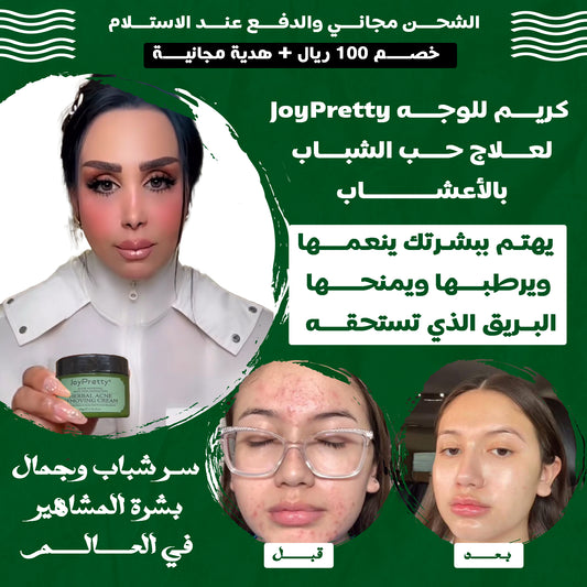 👌👌👌👌👌👌👌👌JoyPretty كريم للوجه لعلاج حب الشباب بالأعشاب